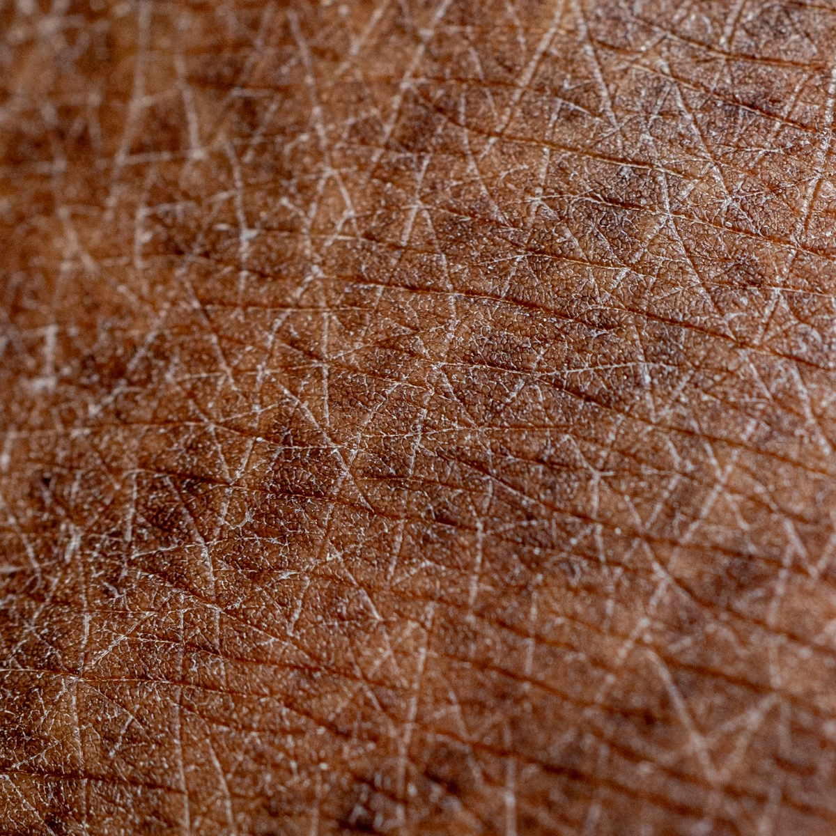 Macro view of dry skin texture with fine surface lines