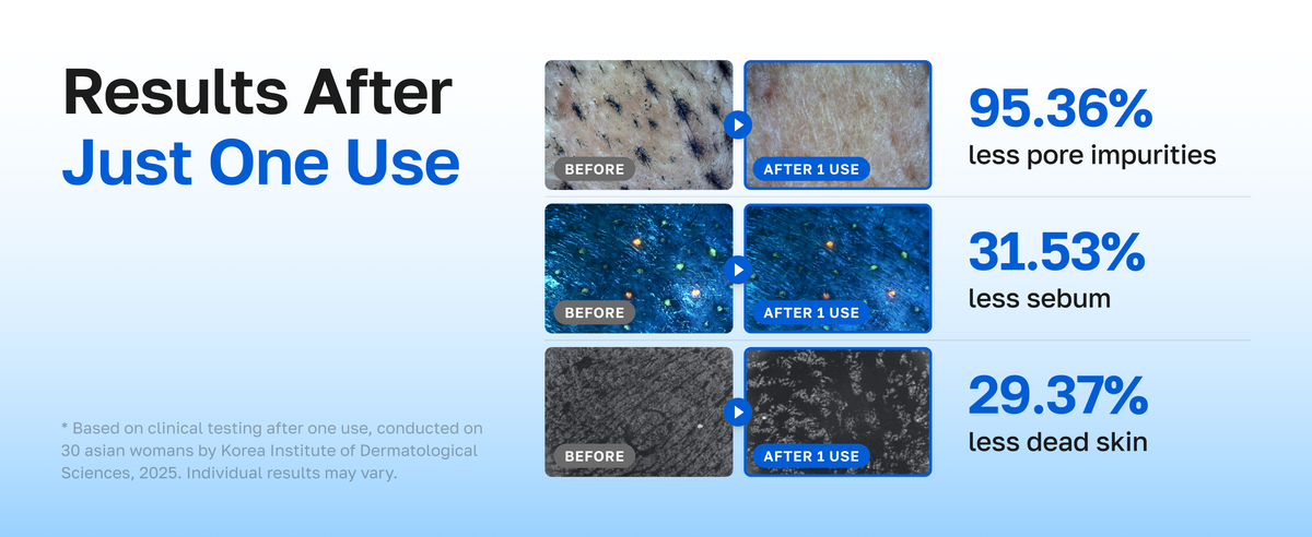 Results after one use: 95.36% less pore impurities, 31.53% less sebum, 29.37% less dead skin