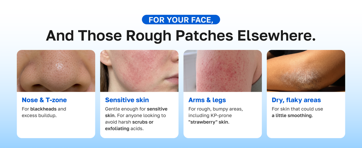 Who it's for: nose and T-zone, sensitive skin, arms and legs, dry flaky areas