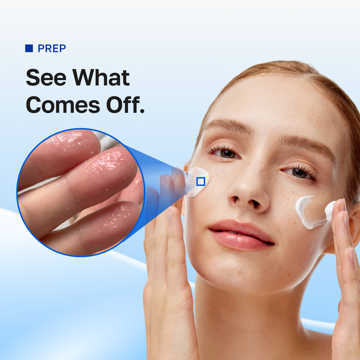 See what comes off: dead skin rolling off after the cream turns to oil
