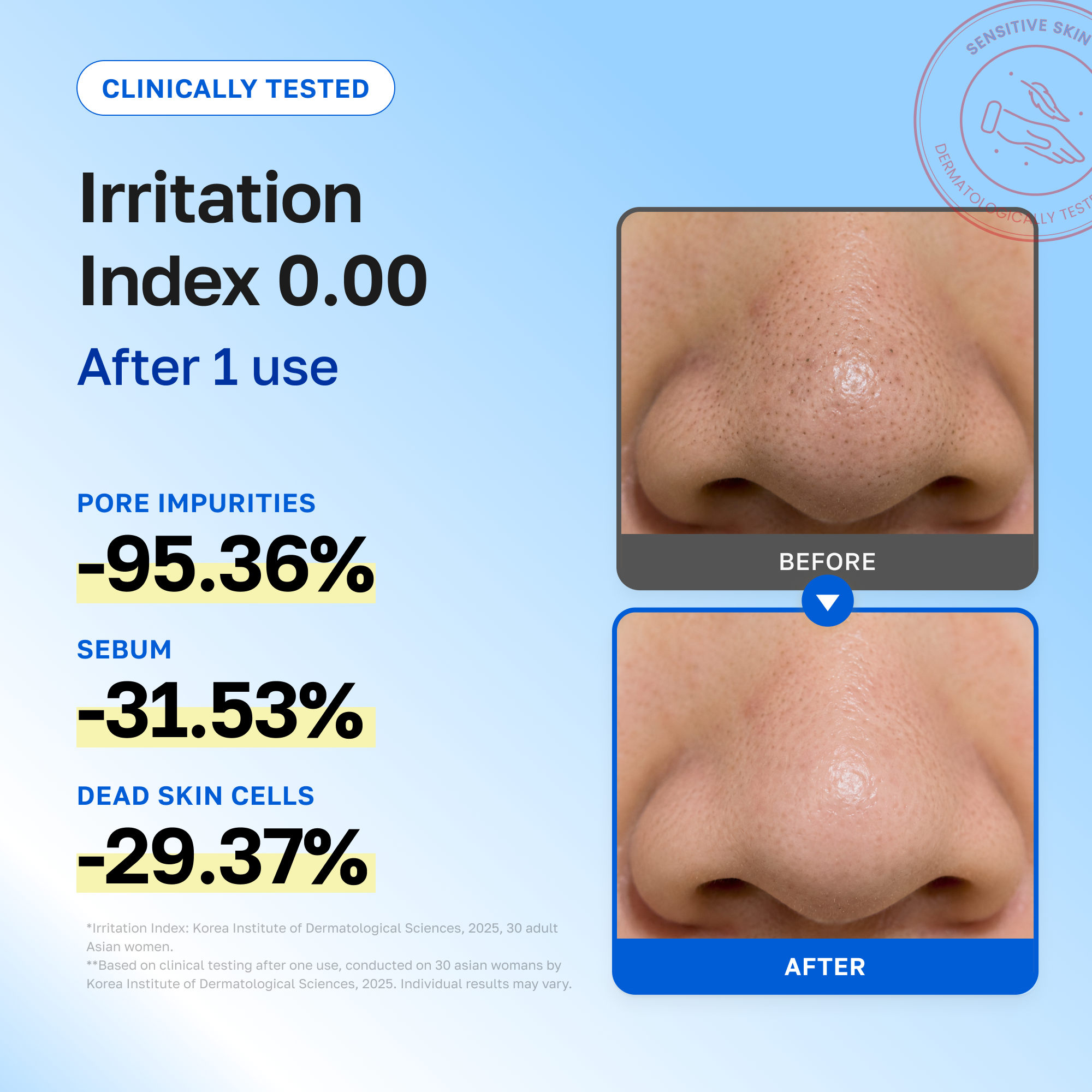 Irritation index 0.00. After 1 use: -95.36% pore impurities, -31.53% sebum, -29.37% dead skin cells