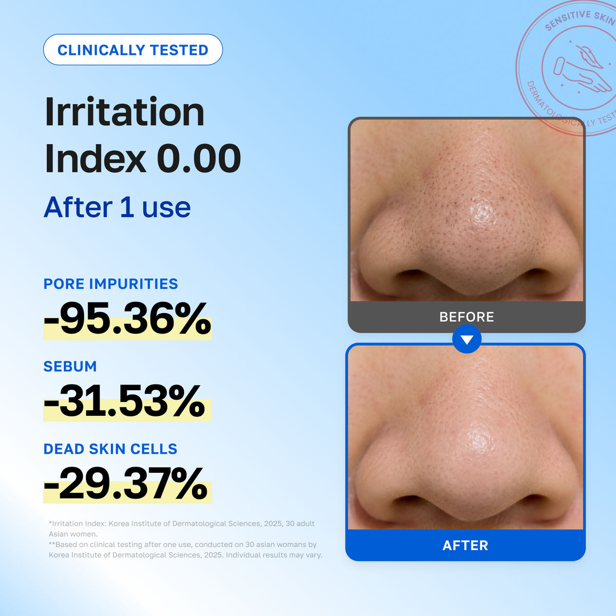 Irritation index 0.00. After 1 use: -95.36% pore impurities, -31.53% sebum, -29.37% dead skin cells