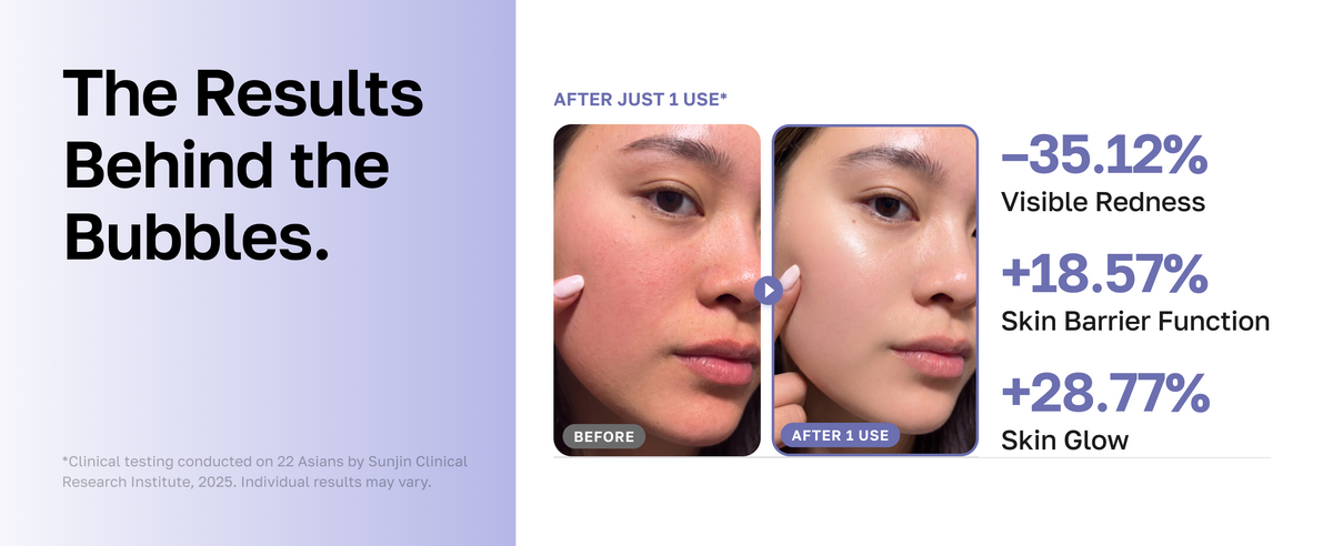 The results behind the bubbles after just 1 use: -35.12% visible redness, +18.57% skin barrier function, +28.77% skin glow